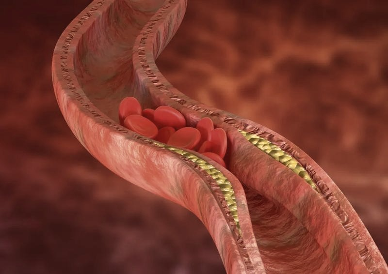 Prawda o cholesterolu – fakty, mity i to, co naprawdę wpływa na jego poziom