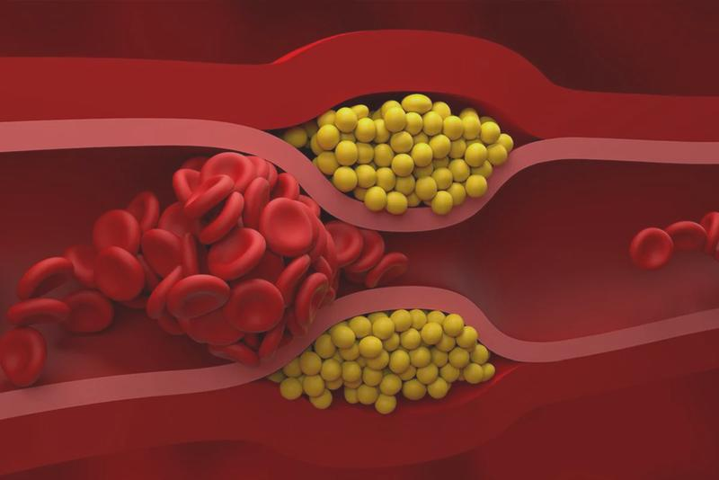 Dieta a cholesterol